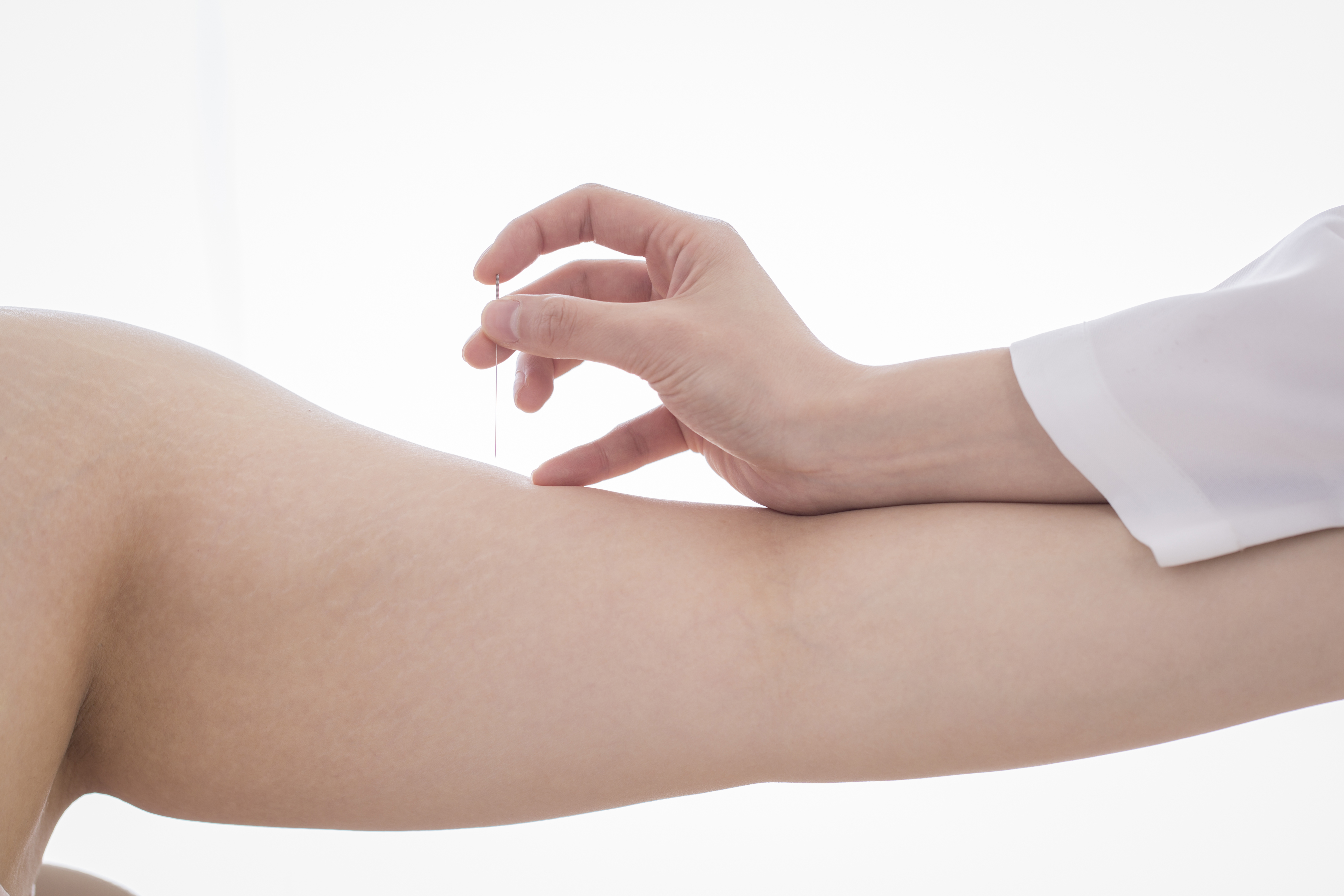 Acupuncture treatment